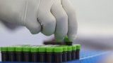 Annonce de l'OMS : Le mpox n'est plus une urgence de santé internationale