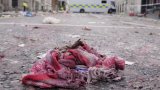 Voiture-bélier à Liverpool : un soir de liesse qui vire au drame