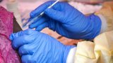 RD Congo: la nouvelle épidémie d'Ebola fait au moins 15 morts