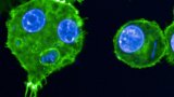 Peste, lèpre... Des chercheurs scrutent les microbes du passé